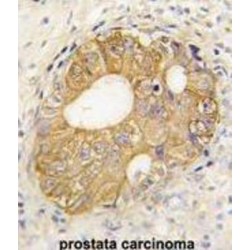 Cadherin 3 (CDH3) Antibody