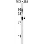 Tetratricopeptide Repeat Protein 33 (TTC33) Antibody