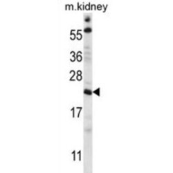 Tetratricopeptide Repeat Protein 33 (TTC33) Antibody