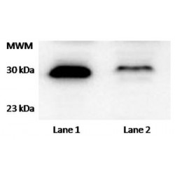 Tetratricopeptide Repeat Protein 33 (TTC33) Antibody