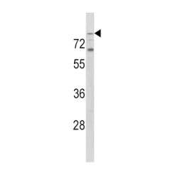 Toll Like Receptor 2 (TLR2) Antibody