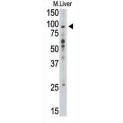 Toll-Like Receptor 6 (TLR6) Antibody