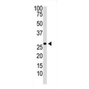 Dickkopf-Related Protein 2 (DKK2) Antibody