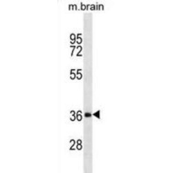 Dickkopf-Related Protein 2 (DKK2) Antibody