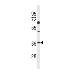 Dickkopf-Related Protein 2 (DKK2) Antibody
