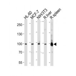 Signal Transducer And Activator of Transcription 5B (STAT5b) Antibody
