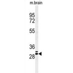 Gap Junction Protein Beta 2 (GJB2) Antibody