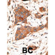 Gap Junction Alpha-3 Protein / CX46 (GJA3) Antibody