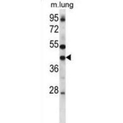 Gap Junction Alpha-4 Protein / CX55 (GJA4) Antibody