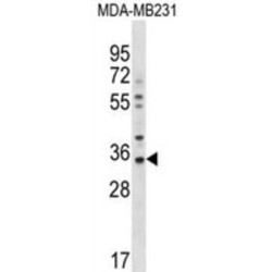Gap Junction Protein Beta 5 (GJB5) Antibody