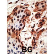 Gap Junction Protein Beta 6 (GJB6) Antibody
