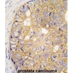 Gap Junction Protein Beta 6 (GJB6) Antibody
