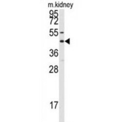 Gap Junction Alpha-8 Protein / CX50 (GJA8) Antibody