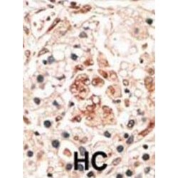 Hippocalcin (HPCA) Antibody