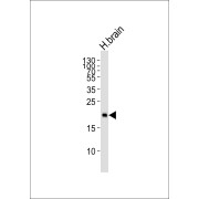WB analysis of Human brain tissue lysate, using Hippocalcin (HPCA) Antibody (1/1000 dilution).