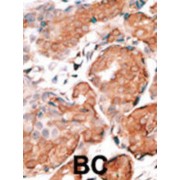 Guanylyl Cyclase-Activating Protein 1 (GUCA1A) Antibody