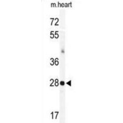 Calsenilin (KCNIP3) Antibody