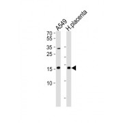Nucleoside Diphosphate Kinase A (NME1) Antibody