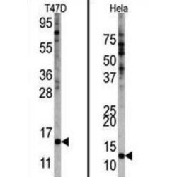 Ubiquitin-Like FUBI-Ribosomal Protein eS30 Fusion Protein (FAU) Antibody