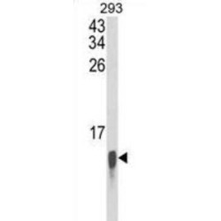 Ubiquitin-Like FUBI-Ribosomal Protein eS30 Fusion Protein (FAU) Antibody