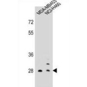 Folate Receptor Beta (FOLR2) Antibody