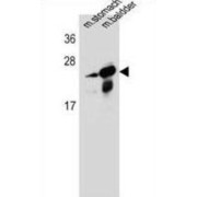 RAB25, Member RAS Oncogene Family (RAB25) Antibody
