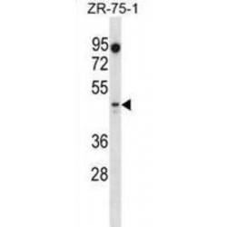 Pre-B-Cell Leukemia Transcription Factor 2 (PBX2) Antibody