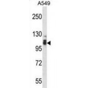 Serine/Threonine-Protein Phosphatase 4 Regulatory Subunit 3B (SMEK2) Antibody