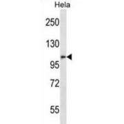 Zinc Finger Protein ZFPM2 (ZFPM2) Antibody