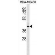Cell Surface Glycoprotein CD200 Receptor 1 (CD200R1) Antibody