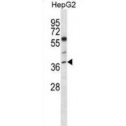 Endonuclease 8-Like 2 (NEIL2) Antibody