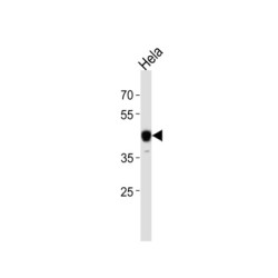 Nuclear Factor 1 C-Type (NFIC) Antibody