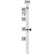 P2Y Purinoceptor 6 (P2RY6) Antibody