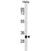 Macrophage-Capping Protein (CAPG) Antibody