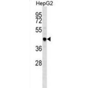 abx028567