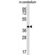 Homeobox Protein Hox-D13 (Hoxd13) Antibody