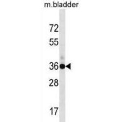 GIPC PDZ Domain Containing Family, Member 1 (GIPC1) Antibody