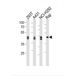Heterogeneous Nuclear Ribonucleoprotein D (HNRNPD) Antibody