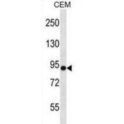 Neuroligin 4, Y-Linked (NLGN4Y) Antibody