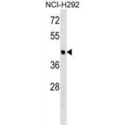 Otolin-1 (OTOL1) Antibody