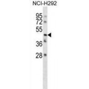 Transmembrane Protein 102 (TMEM102) Antibody