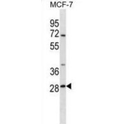 SRP Receptor Beta Subunit (SRPRB) Antibody