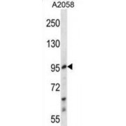 WB analysis of A2058 cell lysates (35 µg).