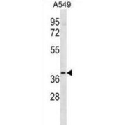 abx028614