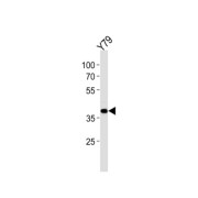 Homeobox Protein SIX3 (SIX3) Antibody