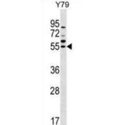 Ferredoxin Reductase (FDXR) Antibody