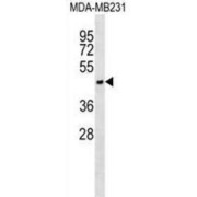 Asialoglycoprotein Receptor 1 (ASGR1) Antibody