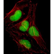 Transcription Factor SOX-18 (SOX18) Antibody