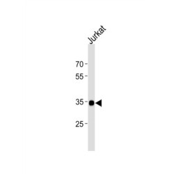 Transcription Factor SOX-18 (SOX18) Antibody