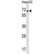 Voltage-Dependent L-Type Calcium Channel Subunit Beta-1 (CACNB1) Antibody